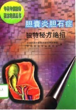 胆囊炎胆石症独特秘方绝招