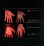 ATLAS OF SAME-SITE DIFFERENTIAL DIAGNOSES VOLUME 1:HANDS AND UPPER EXTREMITIES