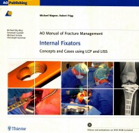 INTERNAL FIXATORS