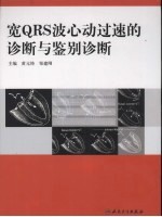 宽QRS波心动过速的诊断与鉴别诊断