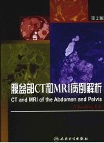 腹盆部CT和MRI病例解析 第2版