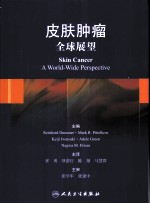 皮肤肿瘤 全球展望