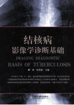 结核病影像学诊断基础