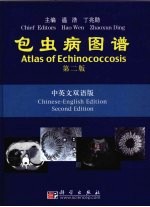 包虫病图谱 中英文 第2版
