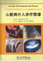 心脏病介入诊疗图谱
