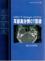 耳部高分辨力CT图谱