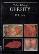 COLOR ATLAS OF OBESITY