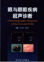 眼和眼眶疾病超声诊断