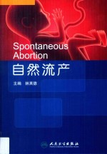 自然流产