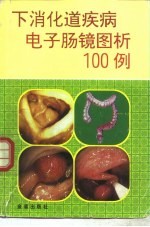 下消化道疾病电子肠镜图析100例