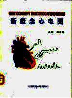 新概念心电图