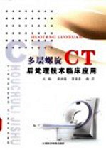 多层螺旋CT后处理技术临床应用