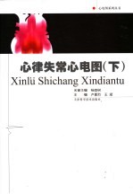 心律失常心电图 下