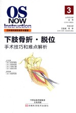下肢骨折 脱位 手术技巧和难点解析