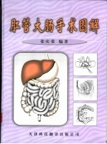 肛管大肠手术图解