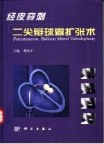 经皮穿刺二尖瓣球囊扩张术