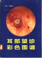 耳部望诊彩色图谱