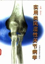 实用类风湿性关节病学