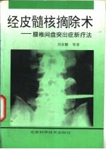 经皮髓核摘除术 腰椎间盘突出症新疗法