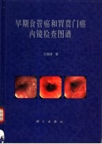 早期食管癌和胃贲门癌内镜检查图谱