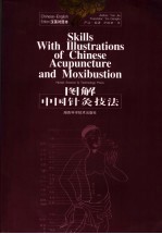 图解中国针灸技法 汉英对照本 Chinese-English edition
