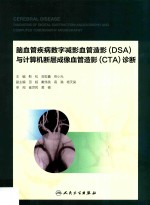 脑血管疾病数字减影血管造影(DSA)与计算机断层成像血管造影(CTA)诊断