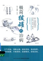 极简拔罐巧治病