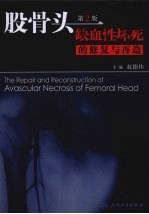 股骨头缺性坏死的修复与再造 第2版