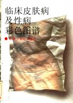 临床皮肤病及性病彩色图谱