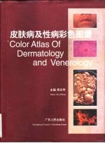 皮肤病及性病彩色图谱