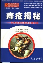 痔疮揭秘 告诉你如何面对肛肠疾病