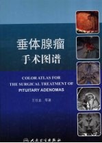 垂体腺瘤手术图谱