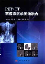 PET/CT两模态医学图像融合