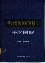 带血管蒂组织瓣移位手术图解
