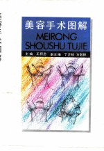 美容手术图解