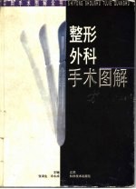 整形外科手术图解