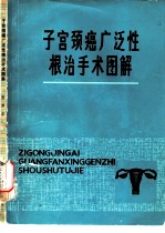 子宫颈癌广泛性根治手术图解