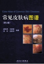 常见皮肤病图谱