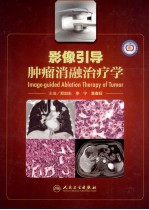影像引导肿瘤消融治疗学