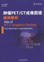 肿瘤PET/CT成像图谱 病例解析