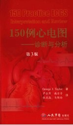 150例心电图 诊断与分析 第3版