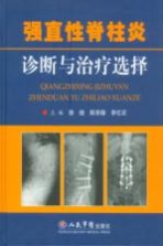 强直性脊柱炎诊断与治疗选择