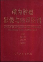颅内肿瘤影像与病理图谱