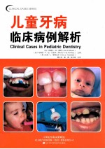 口腔临床病例解析丛书 儿童牙病临床病例解析