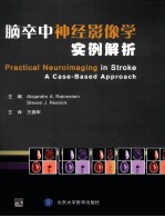 脑卒中神经影像学实例解析