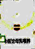 中医论母乳喂养