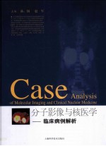 分子影像与核医学 临床病例解析