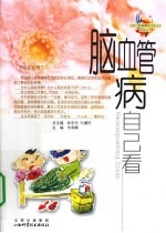脑血管病自己看