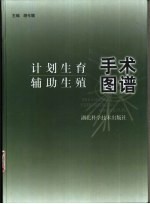 计划生育辅助生殖手术图谱