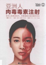 亚洲人肉毒毒素注射